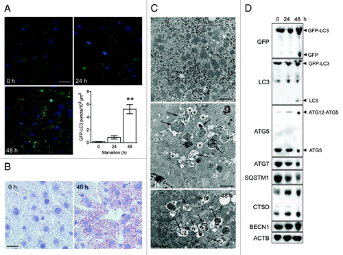 Figure 2. Nutrient deprivation induces autophagy in liver from GFP-LC3 transgenic mice. (A) Examination of GFP fluorescence in liver of GFP-LC3 transgenic mice before (0 h) and after starvation (24 or 48 h). Scale bar, 20 μm. Formation of GFP-LC3 dots during starvation was quantified. **p < 0.01 vs. 0 h (one-way ANOVA, followed by Dunnett test, n = 9). (B) Fatty change of liver tissue as demonstrated by oil red O staining before (0 h) and after starvation (48 h). Scale bar, 20 μm. (C) Ultrastructural characterization of liver tissue from GFP-LC3 mice before (0 h) and after starvation (48 h). The micrographs of starved liver show accumulation of lipid droplets (asterisks) and autophagic vacuoles (arrows). Scale bar, 2 μm. N indicates the nucleus. (D) Western blot analysis of liver from GFP-LC3 mice before and after starvation.