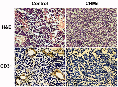 Figure 7. CNMs inhibited neovascularization in retinoblastoma in mice as measured by H&E staining analysis and CD31 staining.