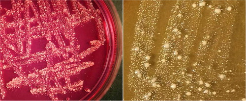 Fig. 1 Swabs from rectal mucosa plated directly on mannitol-salt agar. The samples are from two different patients with irritable bowel syndrome, chronic fatigue and fibromyalgia. Normal coagulase-negative staphylococci (CNS) is seen in mixed population with small colony variants (SCV). The bacteria to the right are mannitol fermenting.