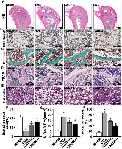Figure 3. LWDH enhances osteogenic capacity and inhibits lipogenic capacity in OVX rats. LWDH enhances osteogenic capacity and inhibits lipogenic capacity in OVX rats. (A) HE staining images of the sections from the distal femur. (B) Immunohistochemical staining images of the osteogenic factor Runx2. (C) Histological evaluation of the Goldner trichome staining in each group, green-stained mineralized bone (MB) and red-stained unmineralized bone (UB). (D) TRAP staining of femur sections. (E) Representative HE staining of femur sections exhibiting the marrow adipose tissue. (F) The quantification of Runx2 in rats from different groups. (G) Quantification of osteoblasts in different groups of rats. (H) Number of fat cells in the femur (n = 6, *p < 0.05 vs. Sham; #p < 0.05 vs. OVX by one-way ANOVA test).