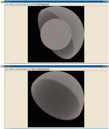 Figure 1. Synthetic radiographs with (a) and without (b) the femoral head. Acetabular version was measured using Elliversion. The user can read the version from the upper label.