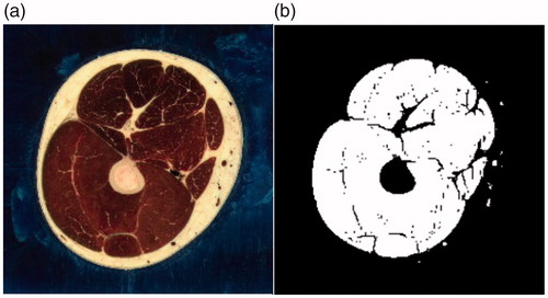 Figure 2. Single slice segmentation of vatus. (a) Before segmentation; (b) After segmentation.