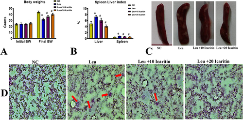 Figure 1 Effect of ICT on ENU-induced leukemia in (A) Body weight; (B) Spleen and liver index; (C) Photographs of the spleen; (D) Images of peripheral blood smears of the experimental group. The red arrow indicates leukemic blast cells. Data are mean ± SD (n = 6). Scale bar= 50 µm, Magnification= 400 ×, *P < 0.01 vs normal control, #P < 0.01 vs Leukemic group.