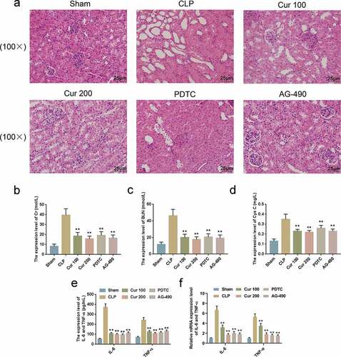 Figure 4. Curcumin alleviated CLP-Induced SAKI of the mice.