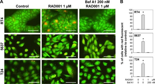 Figure 3 RAD001 induces autophagy in human bladder cancer cells.