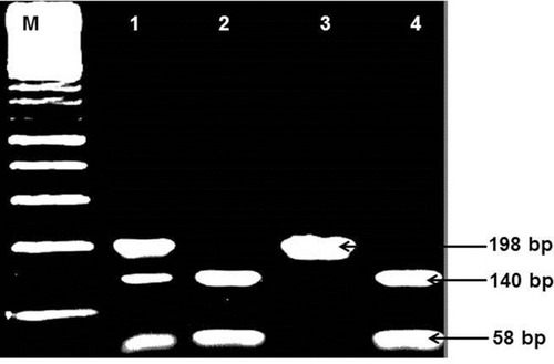 Figure 3 Amplified and digested PCR product of IL-6 (174-G/C). Lane M: 100 bp DNA marker: Lane 1: GC (bands of 198, 140, and 58 bp), Lanes 2 and 4: GG genotype (bands of 140 and 58 bp), Lane 3: CC (uncut DNA of 198 bp).