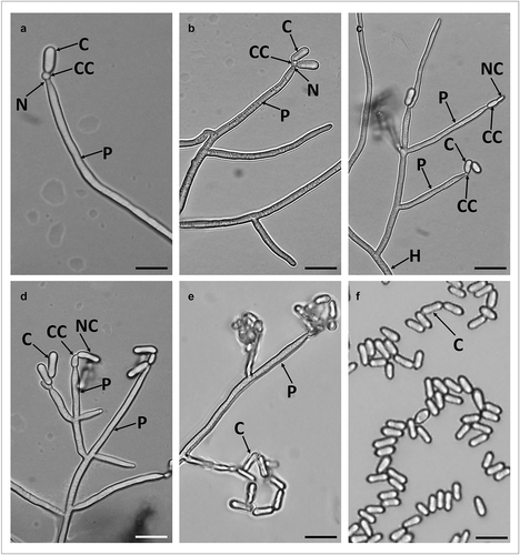 Figure 4. Micrograph of branched conidiophores and conidia formed by M. novozealandicum AgR-F177 on water agar. Conidium (C), Phialide (P), Neck (N), Conidiogenous cell (CC), Hyphae (H), Newly formed budding conidium (NC). Scale bars: 10 µm