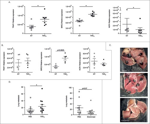 Figure 6. Regulation of metastases dissemination by interfering with the TNFα/TNFR2 interaction. (A) Transcription of Traf1, Birc3 and Ncr1 gene products in mouse splenic NK cells post-stimulation with rTNFα as assessed by RT-PCR at 12 h. Similar experimental settings as with human blood or tumor NK cells. (B) Same settings as Fig. 6A but in TNFR2 KO mice. (C-D) B16F10 melanoma lung metastases dissemination post i.v. injection at 3 weeks without treatment (PBS injection) or with daily inoculation of 1 µg of mouse rTNFα for 3 weeks (D, left) or with an inhibitor of TNFα (Etanercept) twice a week for 3 weeks starting at day 1 post-tumor inoculation (D, right). Representative micrograph pictures of metastatic lungs in each group (C) and concatenated data from 2 experiments yielding similar results (C) at mouse sacrifice. Wilcoxon matched pairs test (A), Mann Whitney test (C, D): * p < 0.05.