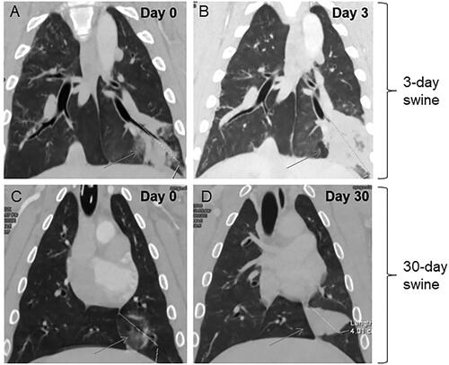 Figure 3. Representative post-ablation, contrast-enhanced CT images for 3-Day (A,B) and 30-Day (C,D) animals. MWAs (100 W, 10 min) were performed in the left caudal regions of the lungs in both animals. Regions where ablations were performed show typical GGO at day 0 in lungs of 3-Day (A) and 30-Day (C) animals. At Day 3, significant tissue density and some atelectasis were observed in the ablation region on Day 3 (B), whereas contraction/involution is shown in the ablation region on Day 30 (D).