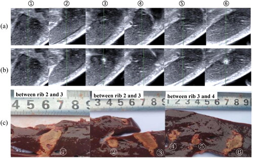 Figure 2. Comparison of sonography (a) before and (b) after FUAS to the liver of the #1 live goat at six different positions, and (c) the corresponding coagulative necrosis after the dissection of treated samples.