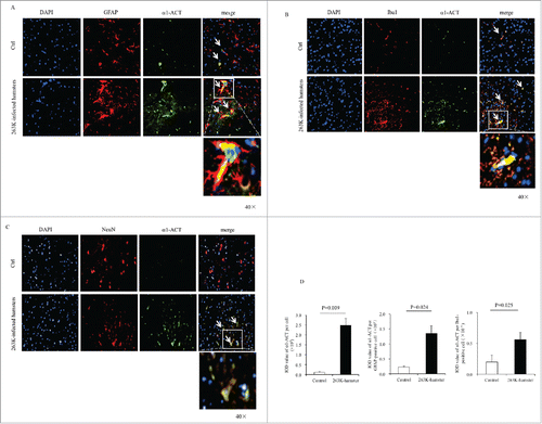 FIGURE 3. Immunofluorescent analyses of the relationships of α1-ACT with various sorts of cells in the brains of 263K-infected hamsters at the end of disease and the age-matched normal hamsters as control. a-c Representative images of the hamsters' brains double-immunostained with the antibodies of α1-ACT (green) and GFAP, (red) (a), Iba1 (red) (b), or NeuN (red) (c) (100 ×). The zoomed-in pictures are shown on the bottom. d Analyses of the IOD values with the software in Operatta. The average IOD values of α1-ACT per cell (× 105) (left panel), per GFAP-positive cell (× 105) (middle panel) as well as per Iba1-positive cell (× 105) (right panel). Statistical differences between infected and normal animals are indicated above.