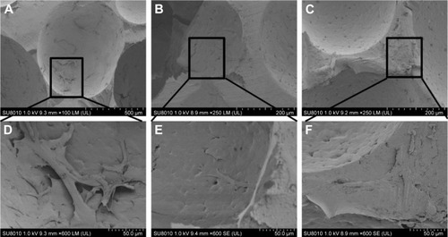 Figure 6 SEM photographs of the BMSCs cultured on (A, D) nHA/PA66, (B, E) SF-nHA/PA66, and (C, F) 0.2 mg/mL CNT/SF-nHA/PA66 scaffolds for 7 days.Abbreviations: BMSCs, bone mesenchymal stem cells; CNT, carbon nanotube; nHA, nano-hydroxyapatite; PA66, polyamide 66; SEM, scanning electron microscopy; SF, silk fibroin.