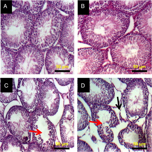 Figure 5 Histopathology of testes from control and 2,5-HD-treated rats. Representative photomicrographs of testes from control (A) and 0.25% 2,5-HD (B) showed normal morphology. Treatment-related lesions such as vacuolization (red arrow) and marked degeneration of the seminiferous tubules (black arrow) were observed in the testes of 0.5% 2,5-HD (C) and 1% 2,5-HD-treated rats (D).