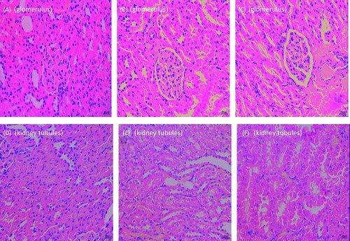 Figure 4. Renal tissue pathology results for the three groups (hematoxylin & eosin staining, 400×). (A) Free MMF-treated group; (B) control group; (C) liposome-encapsulated MMF-treated group; (D) free MMF-treated group; (E) control group; (F) liposome-encapsulated MMF-treated group.