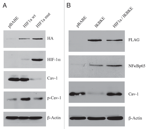 Figure 1 Expression of activated HIF1a or IKBKE in fibroblasts downregulates Cav-1 protein expression. (A) Generating stable fibroblast cell lines expressing HIF1a. hTERT-BJ1 fibroblasts were transduced with retroviral vectors harboring HIF1a (wt, wild-type; or mut, mutationally activated) or the pBABE vector alone as a negative control. After selection for puromycin resistance, the “pool” was subjected to immuno-blot analysis with a battery of antibody probes. HIF1a expression was confirmed using antibodies directed against HIF1a, as well as the HA-epitope tag. Cav-1 expression was monitored with antibodies directed against total Cav-1 and tyrosine-phosphorylated Cav-1 (pY14). Note that activated HIF1a downregulates total Cav-1 levels, but increases the relative levels of phospho-Cav-1. In contrast, wild-type HIF1a only increases the levels of phospho-Cav-1. Immunoblotting with beta-actin is shown as a control for equal loading. (B) Generating stable fibroblast cell lines expressing IKBKE. hTERT-BJ1 fibroblasts were transduced with IKBKE, alone or in combination with activated HIF1a. See the Materials and Methods section for more details on how the double-transfectant was generated. IKBKE expression was confirmed using antibodies directed against NFκB (p65), as well as the FLAG-epitope tag. Cav-1 expression was monitored with antibodies directed against total Cav-1. Note that IKBKE downregulates total Cav-1 levels, but that co-expression of IKBKE and activated HIF1a reverts this phenotype. Immunoblotting with beta-actin is shown as a control for equal loading.