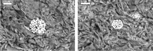 Fig. 7  Back-scattered electron image of pyrite framboids between clay minerals and quartz grains of the well-laminated intervals of the core. Scale bar 5 µm.