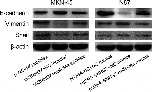 Figure 5. SNHG7 regulates miR-34a-Snail-EMT axis in gastric cancer cells.