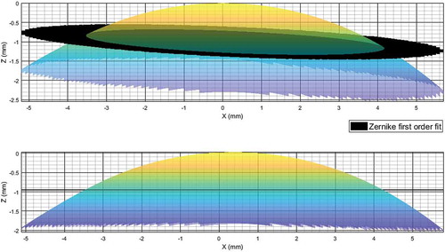 Figure 4. Left eye an Italian participant, same participant as in Figures 3 and 5. (a) As measured by the Pentacam HR where the first-order Zernike fitted surface shown in black. (b) After being leveled by Zernike first-order fit. In this case rotation angles were and .