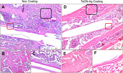 Figure 5 TaON-Ag coated Ti pin achieved bone union as well as the non-coated Ti needle under microscopic histology. Histological evaluation of a fractured femur based on hematoxylin and eosin (H&E) staining revealed trabeculae and callus formation in the non-coated and TaON-Ag-coated groups. The strip space over the center of the image revealed an intramedullary pin tract (A, D). Microscopic images of the peri-implanted bone section of both groups with higher magnification showed no evidence of advanced inﬂammation such as monocyte/eosinophil aggregation (C, F). A well-formed callus was also observed over the united fracture site with higher magnification in both groups without significant difference (B, E).