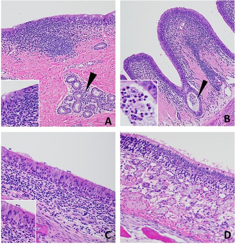 Figure 6. Histopathology of 7 DPC respiratory tissues from calf 673. (A) There was moderate, segmental attenuation and disorganization of the respiratory epithelium with loss of cilia, moderate lymphocyte and/or neutrophil transmigration and individual cellular degeneration and necrosis (Insert). Mononuclear inflammatory cells expanded the lamina propria and were arranged in dense follicular aggregates. Inflammatory cells (lymphocytes and plasma cells) also infiltrated the interstitium between submucosal glands (arrowhead). (B) Mild segmental attenuation of the respiratory epithelium in the bronchi with infrequent cellular degeneration/necrosis. Cellular debris and degenerate neutrophils sporadically accumulated in the lumen or on the epithelial surface (arrowhead and insert). Lymphocytes, plasma cells, macrophages, and lesser numbers of neutrophils expanded the submucosa and extended between submucosal glands. (C) The rostral turbinates had lymphoplasmacytic and neutrophilic infiltrates with epithelial transmigration of inflammatory cells onto the epithelial surface with segmental loss of cilia (Insert). Loose and dense sheets of mixed lymphocytes, histiocytes, and neutrophils infiltrated the subjacent lamina propria and between glands. (D) The olfactory mucosa of the ethmoturbinates was normal. H&E, 40-400× total magnification.