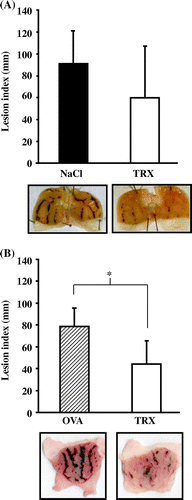 Fig. 4. The effects of yeast TRX on HCl/ethanol-induced gastric ulcers.Notes: (A) Lesion indexes of gastric ulcer (upper figure) and pictures of excised stomachs (lower figure) in recombinant yeast TRX in a 0.85% NaCl solution or a 0.85% NaCl solution alone administered rats (n = 10 in each group). (B) Lesion indexes of gastric ulcer (upper figure) and pictures of excised stomachs (lower figure) in recombinant yeast TRX in a 0.85% NaCl solution (n = 6) or OVA in a 0.85% NaCl solution (n = 5) administered rats. The values are given as mean ± SD. The *symbol indicates values significantly different at p < 0.05.