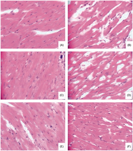 Figure 3. Effect of HSYA on the hypertrophy of cardiomyocytes (H&E, ×400): (A) Sham-operated rats, (B) Model rats, (C) rats treated with captopril (100 mg/kg), (D) rats treated with HSYA 10 mg/kg, (E) rats treated with HSYA 20 mg/kg, and (F) rats treated with HSYA 40 mg/kg.