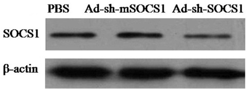 Figure 1 Western blot analysis of SOCS1 silencing. SOCS1 and β-actin proteins were identified using anti-SOCS1 polyclonal and anti-β-actin monoclonal antibodies (Santa Cruz Biotechnology, Santa Cruz, CA, USA), respectively.