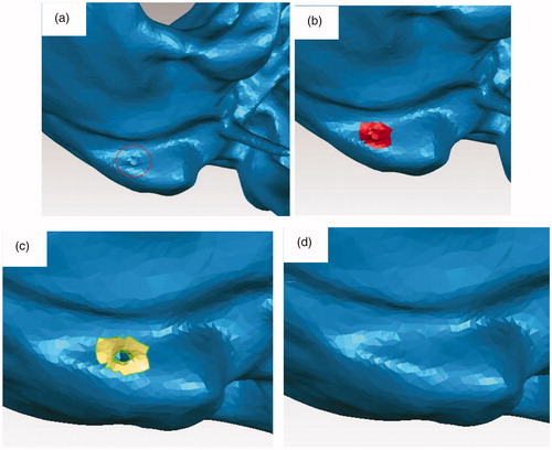 Figure 7. Repair the hole in the surface. a) There is a hole in the red circle; b) We select the hole and the surroundings; c) We delete the hole and make it a bigger hole; d) We select Fill Holes > Fill All to repair the big hole.