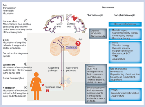 Figure 1. Schematic representation of the pain-signaling pathway.Diagram showing the sites of action of different categories of pharmacologic and nonpharmacologic treatments, as well as their potential in the modulation of pain between the peripheral nervous system and CNS (brain and spinal cord). From the site of injury, such as an amputation, nociceptors send signals to the spinal cord (transduction) and then to the brain (transmission) through the ascending pathways where the pain is treated (perception). Pain signal is then modulated through the descending pathways. On the left hand side of the figures are mentioned the different parts of the human body that are implicated in the pain pathway from the site of injury to the homunculus in the brain via the spinal cord. On the right hand side of the diagram, the different options among pharmacological and nonpharmacological treatments are listed as well as their known sites of action along the signaling pain pathway.NSAID: Non-steroidal anti-inflammatory drug; TENS: Transcutaneous electrical nerve stimulation.
