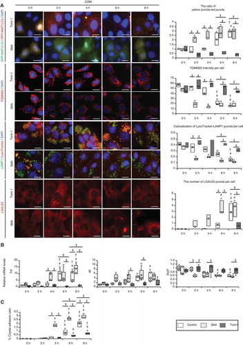 Figure 5. MTOR inhibition suppresses inflammation and crystal adhesion. (A) Ratio of yellow:red puncta, mean intensity of TOMM20 per cell, colocalization of LysoTracker-LAMP1 puncta per cell, and number of LGALS3 per cell in RTCs transfected with tfLC3; immunostained for TOMM20, LAMP1, and LysoTracker; counterstained with DAPI; and stained for LGALS3 after COM exposure and 3-MA or Torin1 treatment. The control group was treated with COM only. At least 30–50 cells were counted (n = 3). (B) Gene expression (Tnf, Il6, and Sod1) in RTCs with COM exposure and 3-MA or Torin1 treatment (n = 5). (C) Adhesion ratio to RTCs after COM exposure and 3-MA or Torin1 treatment. Images were obtained from 10 random fields. At this resolution, there were 200–300 cells per field (n = 3). Scale bars: 20 μm (A). Each value for yellow:red puncta at 0 h was adjusted to ‘1’ as a reference (A). *P < 0.05 versus 0 h with the same treatment, #P < 0.05 versus 2 h with the same treatment, †P < 0.05 versus 4 h with the same treatment, and ‡P < 0.05.