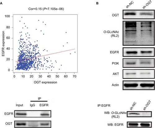 Figure 4 OGT suppression downregulates EGFR.Notes: (A) Correlation between OGT expression and EGFR in TCGA datasets. (B) Effect of OGT knockdown on EGFR and PI3K/AKT expression in RCC cells. (C) Interaction between OGT and EGFR in 786-O cells, as determined by co-immunoprecipitation and immunoblot. (D) 786-O cells were treated with sh-NC or sh-OGT followed by EGFR immunoprecipitation with anti-EGFR antibodies; the resulting EGFR immunoprecipitates were assessed by WB for EGFR and O-GlcNAc (RL2) detection.Abbreviations: Cor, correlation; EGFR, epidermal growth factor receptor; IP, immunoprecipitation; OGT, O-GlcNAc-transferase; O-GlcNAc, O-linked N-acetylglucosamine; NC, negative control; RCC, renal cell carcinoma TCGA, The Cancer Genome Atlas; WB, Western blot.