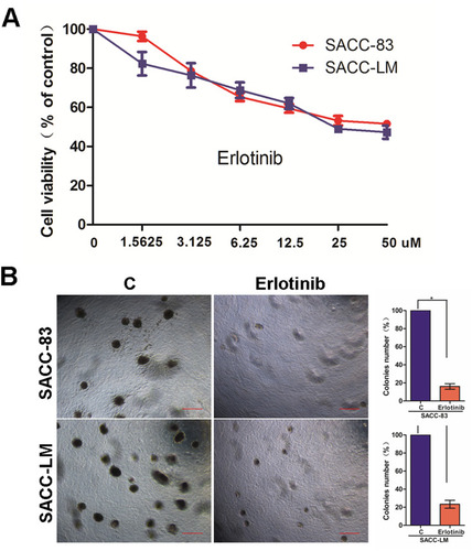 Figure 1 Targeting EGFR with erlotinib suppressed SACC cell growth and colony formation. (A) The growth of SACC-83 and SACC-LM cells treated with erlotinib was analyzed using a CCK-8 kit; symbols represent the mean values of triplicate tests (mean ± SD). (B) Microphotographs showing colonies from anchorage-independent growth analysis of SACC-83 and SACC-LM cells treated with or without erlotinib (2 µM). The bar graphs indicate the mean (and standard error) number of colonies from four wells, and statistically significant differences are indicated with * (P < 0.01).