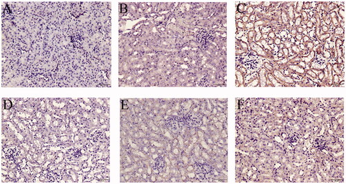 Figure 9. Local expression of TNFα in mice kidneys. (A) Blank control, (B) Vehicle control, (C) TCE+, (D) TCE−, (E) TCE + R7050+, (F) TCE + R7050− mice. Magnification 400×. Scale bars = 50 μm. Representative blots from each group are shown.