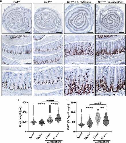 Figure 7. Loss of epithelial-specific talin-1 enhances pathogen-induced colonic hyperplasia. (a) Representative images of colon tissues immunoperoxidase-stained for Ki-67. n = 4 uninfected mice and n = 4–5 infected mice per genotype. (b) Colonic crypt length. Each dot represents an individual crypt that was visible from base to opening; n = 70–107 crypts counted from 4 different mice per group. (c) the proportion of the individual crypts that contained Ki-67+ nuclei determined by measuring from the base of the crypt to the last positive nuclei. All values reported with the median depicted as a thick line and the upper and lower quartiles as thin lines. Statistical analyses, where shown; **P < 0.01 and ****P < 0.0001 determined by 1-way ANOVA and Kruskal-Wallis test. Thick scale bars represent 1000 μm and thin scale bars represent 100 μm.