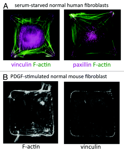 Figure 1. (A) Wild-type human lung IMR-90 fibroblasts plated on 50 μm2 fibronectin islands in serum-free medium. F-actin was labeled with Alexa-488 phalloidin (green) and FA proteins (vinculin and paxillin) were labeled by immunostaining. (B) Wild-type mouse embryonic fibroblast on a 50 μm2 fibronectin island, stimulated with PDGF (25 ng/ml) for 30 min. F-actin was labeled with Alexa-488 phalloidin and vinculin was labeled by immunostaining.