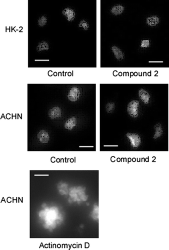 Fig. 3. Compound 2 does not cause morphological changes of nucleus.Notes: Morphological changes in the nuclei of HK-2 and ACHN cells treated or left untreated with 2 were examined as described in Materials and methods (scale bar, 30 μm). Actinomycin D was used as positive control.