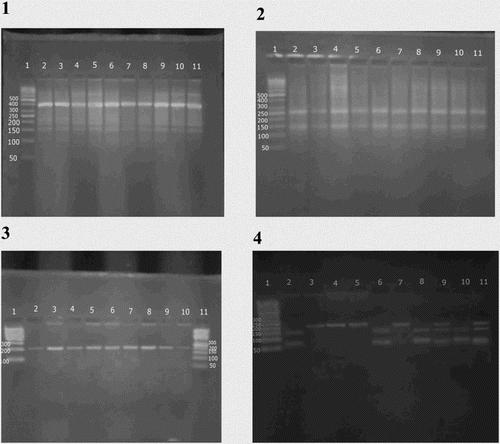 Figure 1. Agarose gel electrophoresis of (1) amplification product of HFE gene at 387 bp. Lane 1 shows 50 bp ladder; lanes (2, 3, 4, 5, 6, 7, 8, 9, 10, and 11) show the amplification product of HFE gene at 387 bp. (2) Digestion products of HFE gene by RsaI at 247 and 140 bp. Lane 1 shows 50 bp ladder; lanes (2, 3, 4, 5, 6, 7, 8, 9, and 10) show GG homozygote (normal alleles) at (247–140) bp, lane 11 shows 100 bp ladder. (3) Amplification product of HFE gene at 208 bp. Lane (1) shows 100 bp ladder; lanes (2, 3, 4, 5, 6, 7, 8, 9, and 10) show the amplification product of HFE gene at 208 bp; lane (11) shows 50 bp ladder. (4) Digestion products of HFE gene by BclI at 70, 138, and 208 bp. Lane 1 shows 50 bp ladder; lanes (2, 6, 8, and 10) show CC homozygote at (70–138) bp, lanes (3, 4, 5, and 7) show GG homozygote at (208) bp and lanes (9 and 11) show CG heterozygote at (70–138 and 208) bp.