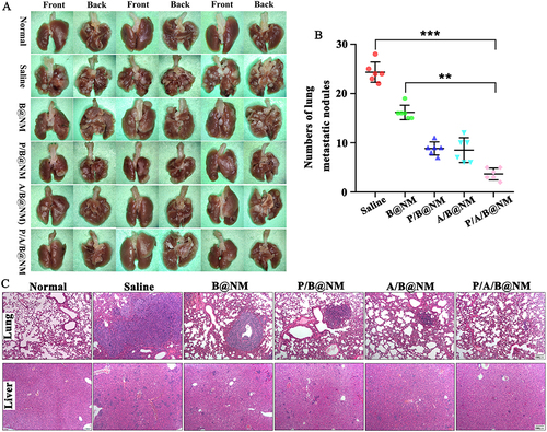Figure 4 Co-delivery nanomicelles based combination therapy inhibit the lung and liver metastasis of tumor cells in 4T1 orthotopic TNBC mice. (A) The representative photographs of tumor metastasis in lungs of mice. (B) Effect of co-delivery nanomicelles on lung metastasis nodules in mice (n=6). (C) Pathological analysis of metastasis in lung tissues and liver tissues after co-delivery nanomicelles treatment in orthotopic TNBC mice. Error bars represent means ± SEM. **P < 0.01, ***P < 0.001.