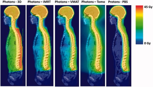 Figure 1. Craniospinal axis dose distribution with photons (3D-CRT, IMRT, VMAT, Tomotherapy) and protons. Only one out of three generated plans per technique is depicted.