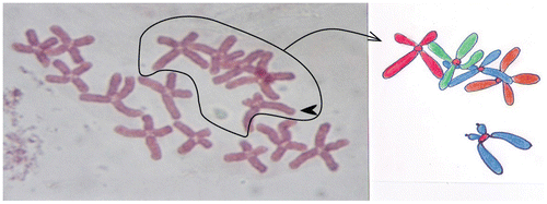 Figure 5. Monosomy (2n – 1) in the chromosome set of the onion (Allium cepa L.). Subtelocentric chromosome (arrow) is without homologue couple in chromosome set.