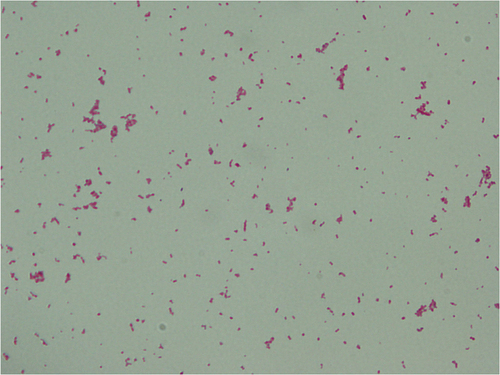 Figure 4. Growth of Gram-negative bacilli on anaerobic medium from intraoperative specimens collected during fasciotomy of the leg.