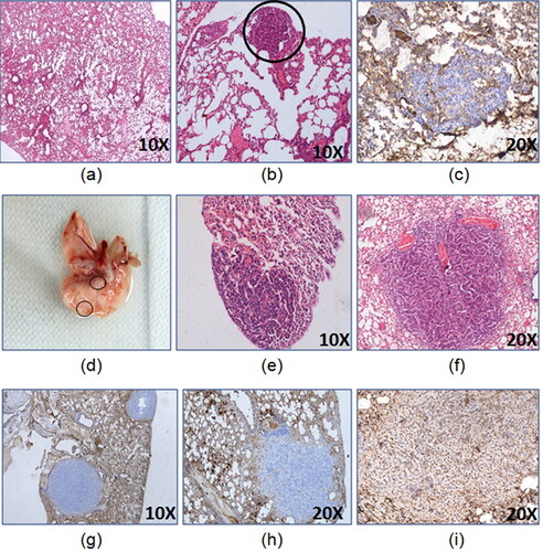 Figure 2. Development of lung adenocarcinoma 24 weeks model. The representative images of lungs (a) control, (b) H&E of tumor lesion at 8th week of latency, (c) CK7- 8th week of latency tumor lesion, (d) gross tumor lesion at 16th week of latency,(e) H&E of tumor lesion at 16th week of latency, (f) H&E of lung tumor lesion at 24th week of latency, (g) CK7- 24th week of latency tumor lesion, (h) Napsin A- 24th week of latency tumor lesion, (i) TTF-1+24th week of latency tumor lesion.