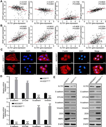 Figure 3 ELTD1 Facilitates EMT of GC Cells. (A) The Pearson correlation between ELTD1 and epithelial markers (CDH1, EPCAM), mesenchymal markers (VIM, CDH2) was analyzed using TCGA STAD data. (B) The Pearson correlation between ELTD1 and EMT transcription factors (ZEB1, ZEB2, SLUG, TWIST2) was analyzed using TCGA STAD data. (C) Cytoskeleton of indicated cells is visualized by staining F-actin with rhodamine-phalloidin. Scale bars, 5 μm. (D) qRT-PCR was used to detect the expression of EMT markers in ELTD1-interfered and control cells. (E) Western blot assay was used to detect the expression of EMT markers, ZEB1, and MMP2 in ELTD1-interfered and control cells.