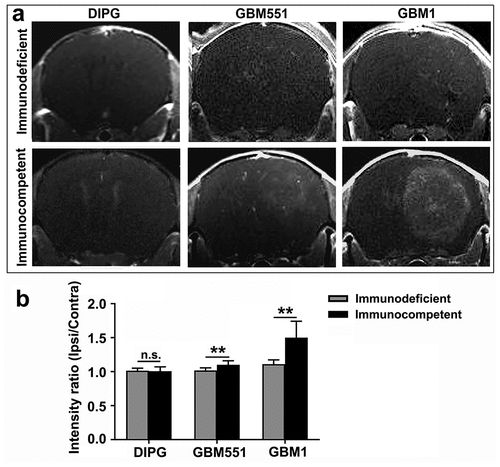 Figure 5. Blood–brain barrier status in immunodeficient and immunocompetent hosts of DIPG, GBM1, and GBM551 tumors. (a) Representative T1-Gd MRI images of the DIPG, GBM551, and GBM1 xenografts in immunodeficient and immunocompetent mice. (b) Quantification of the different tumor graft assessment for T1 intensity. N = 9 slices from three animals/group. Mean ± SD, **p < 0.01, n.s. is no significant difference, independent t-test.
