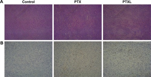 Figure 9 H&E and TUNEL staining of keloids in nude mice.Notes: (A) Keloid H&E staining of control, PTX and PTXL group (magnification: ×100). (B) Keloids TUNEL staining of control, PTX and PTXL groups (magnification: ×200).Abbreviations: H&E, hematoxylin and eosin; PTX, paclitaxel; PTXL, paclitaxel–cholesterol-loaded liposomes.