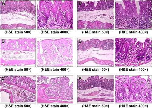 Figure 4 Histological features of colons after 30 days treatment.Notes: (A) Nanoparticles of XG:GG, (B) 5-FU powder, (C) 5-FU nanoparticles, (D) probiotics, (E) probiotics + 5-FU powder, and (F) probiotics + 5-FU nanoparticles.Abbreviations: XG, xanthan gum; GG, guar gum; 5-FU, 5-fluorouracil; H&E, hematoxylin and eosin.