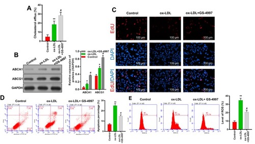 Figure 4 ASK1 inhibition increased cholesterol efflux and cell proliferation, and reduced ROS production and cell apoptosis. An ASK1 inhibitor (GS-4997) was used to treat ox-LDL-induced endothelial cells. (A) A Cholesterol Efflux Assay Kit was used to analyze the levels of cholesterol efflux. (B) ABCA1 and ABCG1 expression were evaluated by Western blotting. (C) EdU staining was used to determine the viability of endothelial cells; magnification, ×100. (D) Cell apoptosis was determined by Annexin V FITC/PI double staining. (E) ROS levels were examined by flow cytometry. *P < 0.05, **P < 0.01 vs control group; #P < 0.05 vs ox-LDL group.