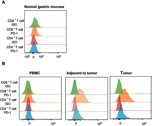 Figure 4 Representative flow expression of PD-1 on CD4+ T-cell and CD8+ T-cell in the normal gastric mucosa and in HGIN. (A) The representative flow expression of PD-1 and its isotype on CD4+ T-cell and CD8+ T-cell in normal gastric mucosa; (B) The representative flow expression of PD-1 and its isotype on CD4+ T-cell and CD8+ T-cell in HGIN.Abbreviations: HGIN, High-grade Intraepithelial neoplasia; PD-1, programmed death-1.