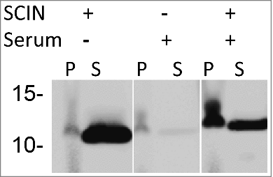 Figure 4. Binding of SCIN to S. aureus cells increases upon incubation in serum. Western blotting analysis of S. aureus Newman ΔspaΔsbi cells collected by centrifugation (P) and growth medium fractions (S) using 6D4–800CW. The presence or absence of C3 convertases due to serum incubation, and the addition or absence of SCIN are indicated with + or -, respectively.