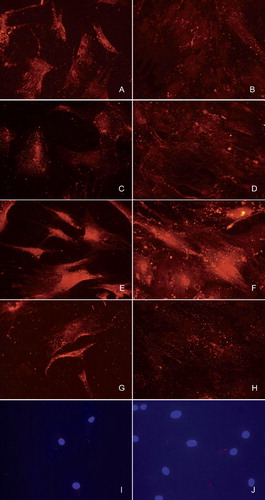 Figure 4. Immunofluorescence staining of undifferentiated bone marrow-derived human mesenchymal stromal/stem cells (A, C, E, G, and I) and after differentiation for 14 days in osteogenic medium (B, D, F, H, and J). Staining for BMP-2 (A, B), BMP-4 (C, D), BMP-6 (E, F), and BMP-7 (G, H). Negative control is staining with normal nonimmune goat IgG (I, J). Nuclear staining with DAPI is shown to demonstrate the presence of cells in the photographed sample fields.